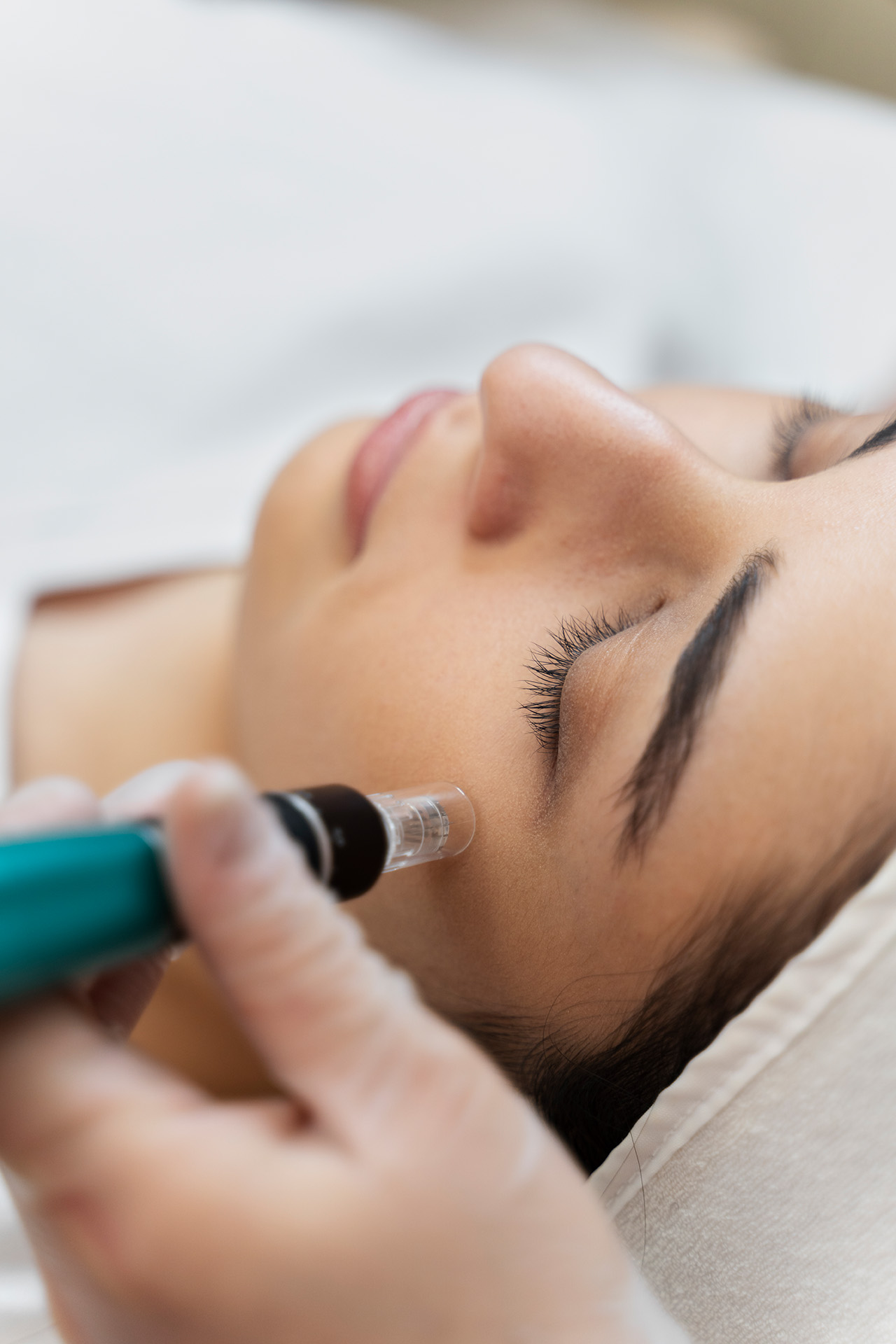 microneedling behandlung tanja neufeld